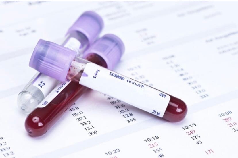 https://infertility.su/diagnostics/31807/