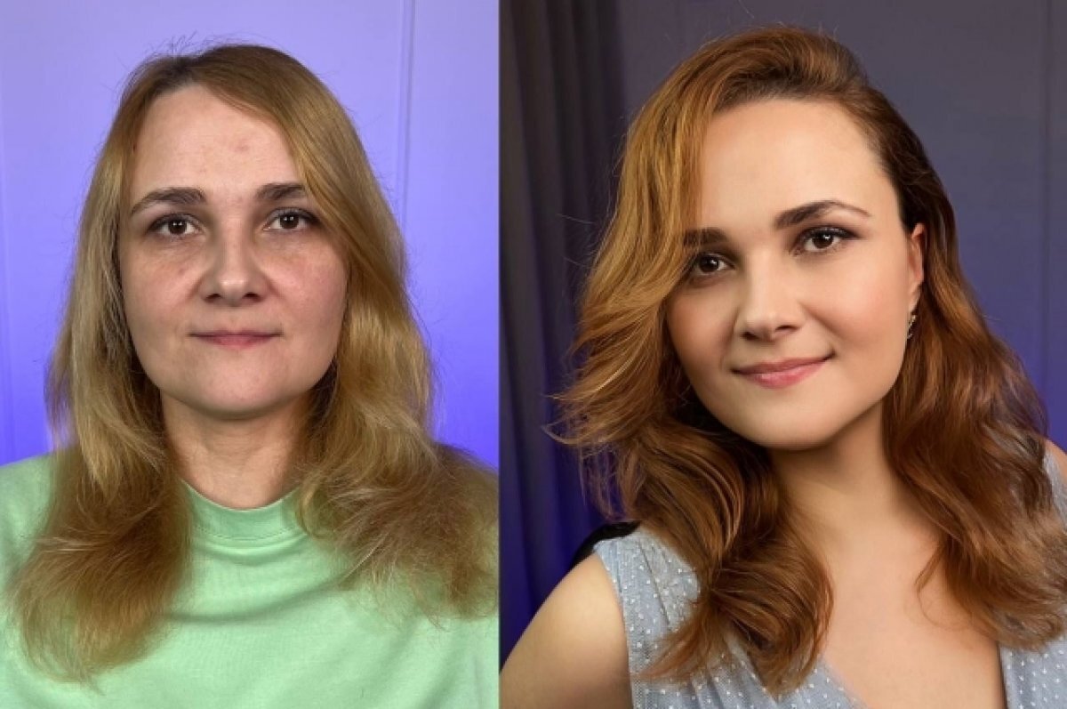    Челябинка выиграла два миллиона рублей на коррекцию внешности