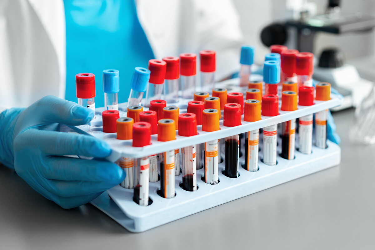 С 1 июля 2021 г. в дополнение к профилактическим медицинским осмотрам и диспансеризации граждане, переболевшие новой коронавирусной инфекцией, вправе пройти углубленную диспансеризацию 