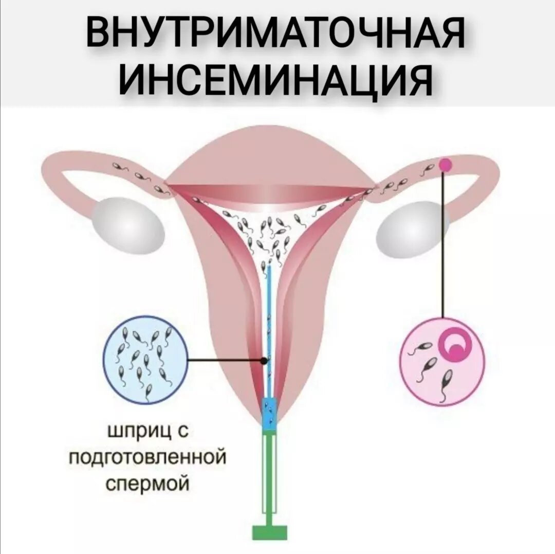 попадание спермы на половые органы можно ли забеременеть фото 78