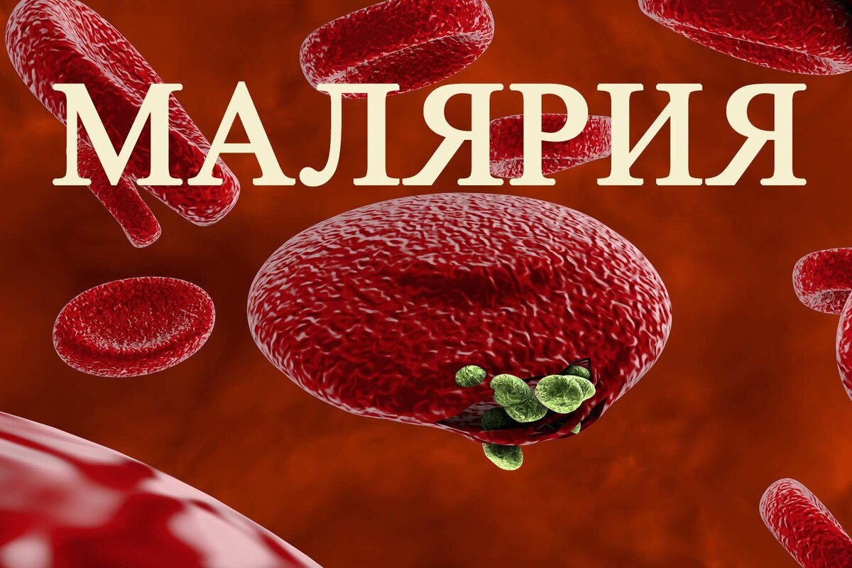 Я маляр. Малярия инфекционные болезни.