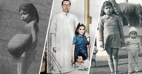 девочка рожает в 5 лет