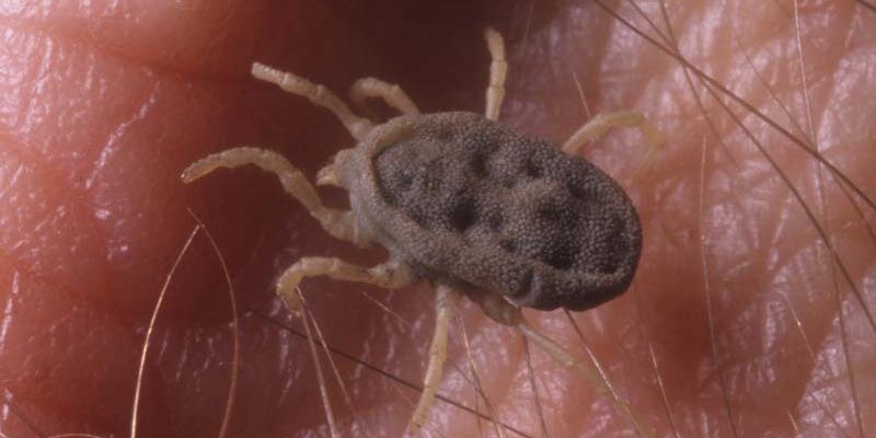 Клещ семейства Argasidae на коже человека