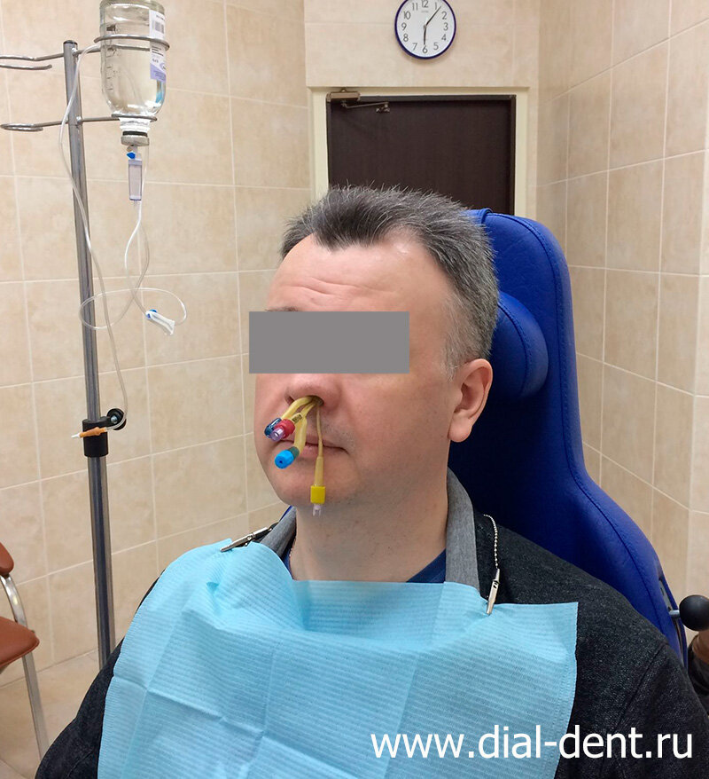 Лечение гайморита без прокола методом ЯМИК