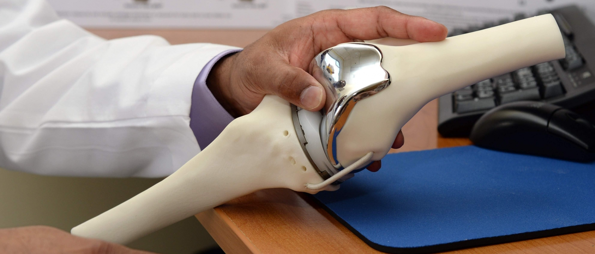 Форум операции по замене суставов. Титановые протезы. Титан в медицине протезы. Эндопротезирование коленного Ялте.