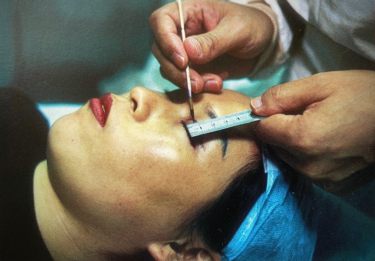 Также одно из первых мест по количеству операций занимает увеличение разреза глаз: "западный" вид очень важен и для приема на работу, и для замужества.