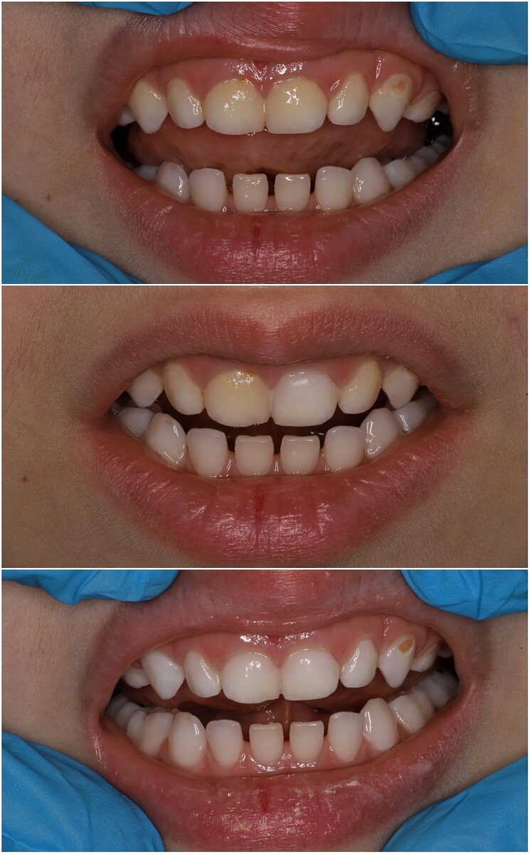 Чаще всего я слышу фразу "Ну он же взрослый! Уже сам чистит зубы".