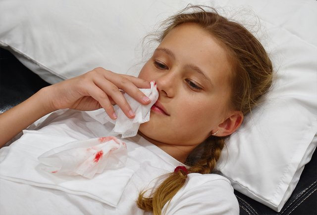 Кровь из носа: причины, как помочь и когда идти к врачу?