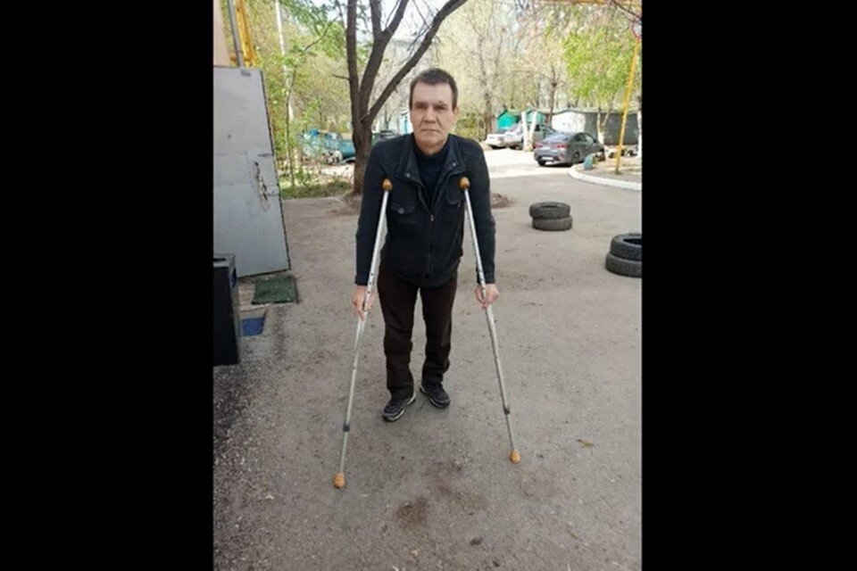     Виталий лишился ступней ног и одного глаза. Фото: предоставлено "Комсомолке"