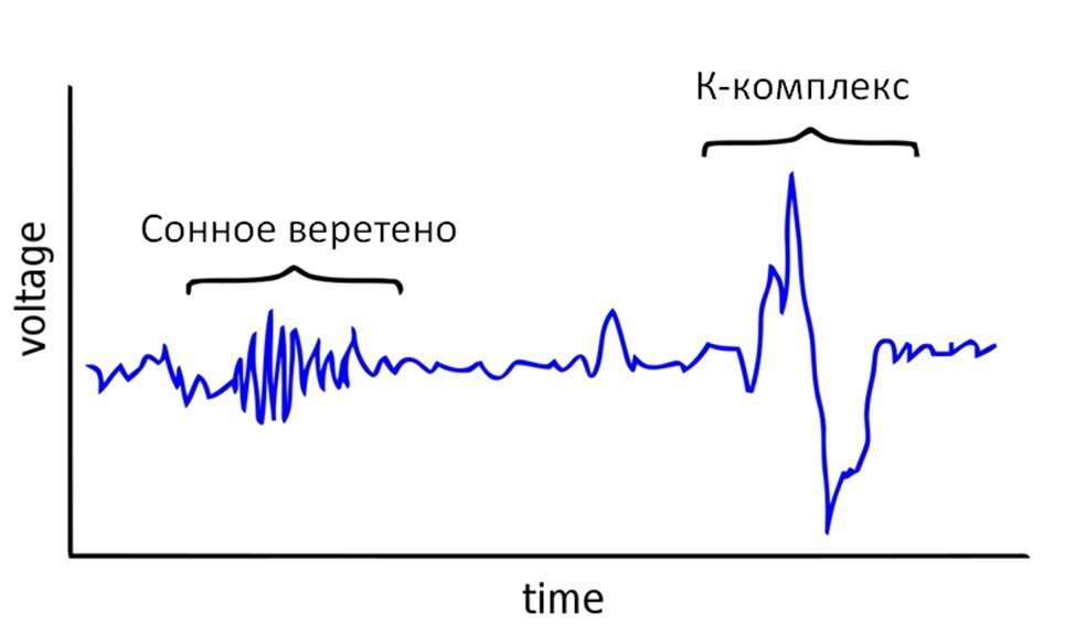 Веретёна и К-комплексы собственной персоной