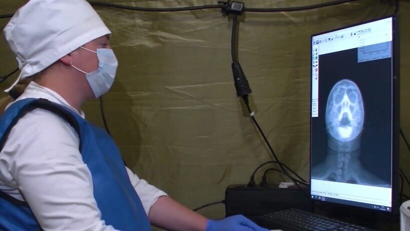 Врач из Краснодара приехал добровольцем в Запорожскую область: в 76 лет в зоне С