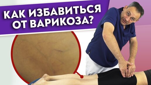 Download Video: Как убрать ВАРИКОЗ? Варикозное расширение вен — причины и лечение.