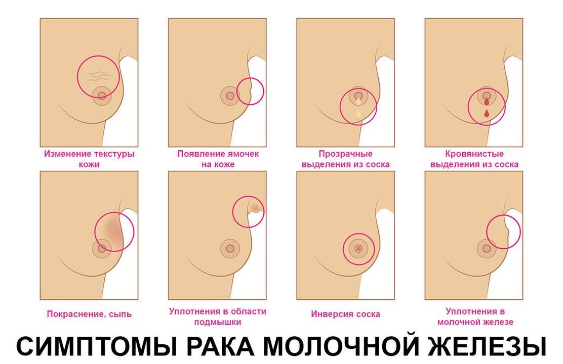 Виды УЗИ, которые нужно делать ежегодно | Evolutis Clinic | Дзен