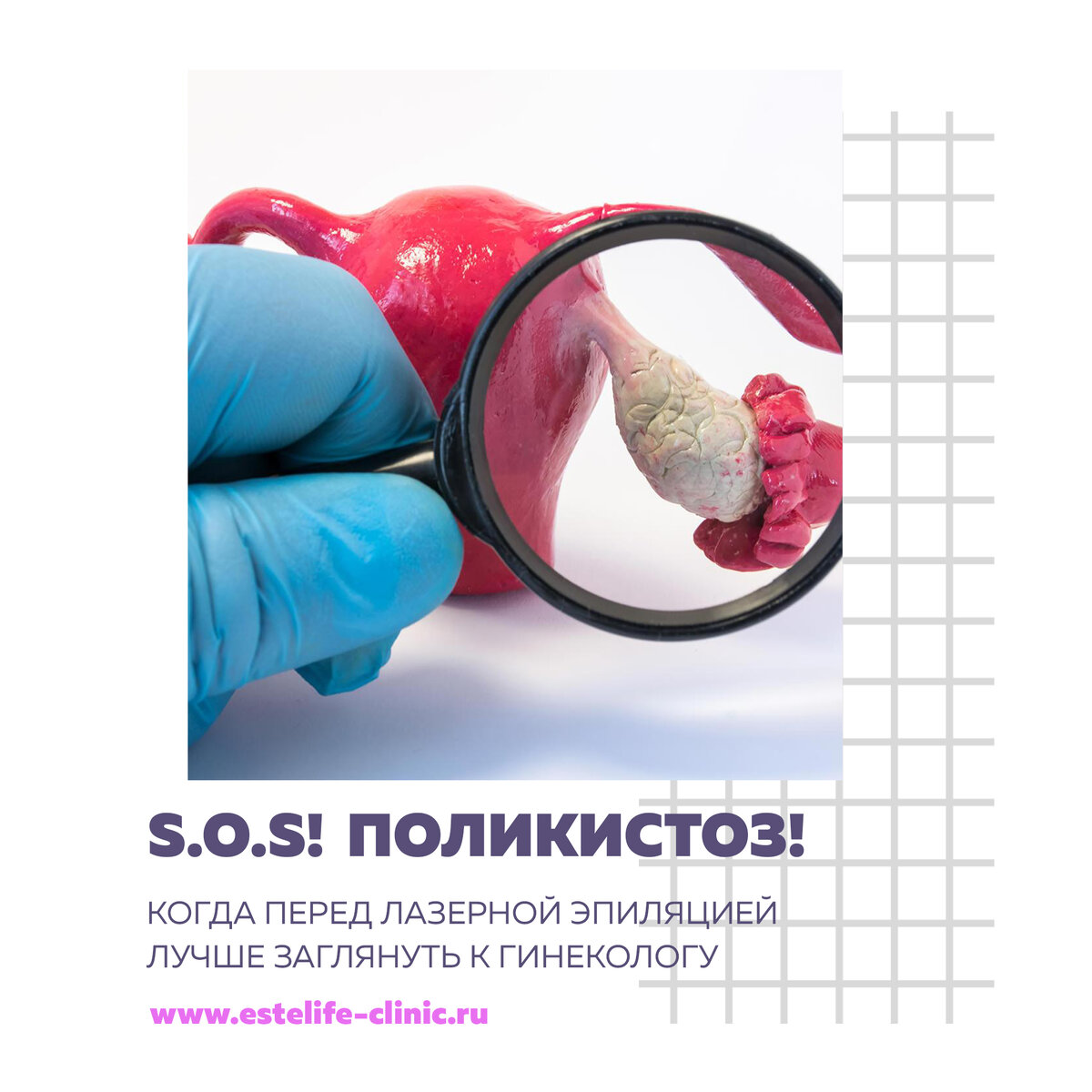 Симптомы поликистоза