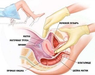Гинекологический массаж
