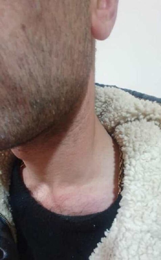 Срочно! На территории общины Гетаван Нагорного Карабаха азербайджанцы применили насилие в отношении армянской молодежи. ФОТО