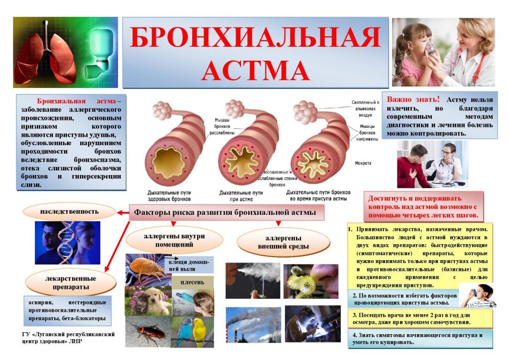 Картинки про бронхиальную астму