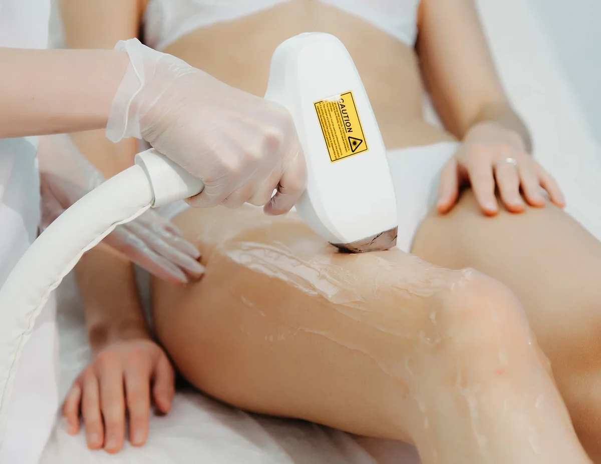 Лазерная эпиляция: от изобретения до современности