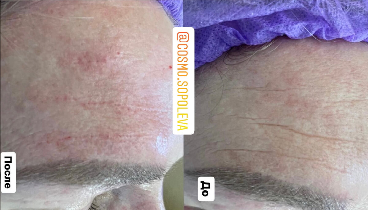 Использую фото своих работ.