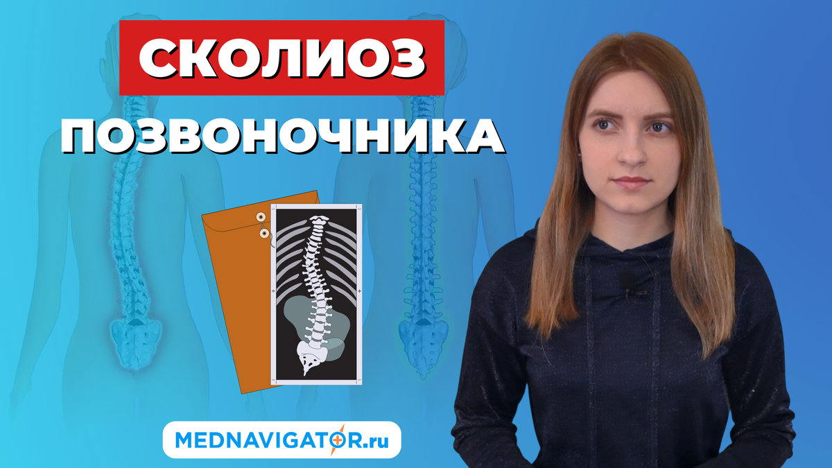 СКОЛИОЗ позвоночника 1, 2, 3 и 4 степени у детей и взрослых - симптомы,  причины, диагностика | Mednavigator.ru | Дзен