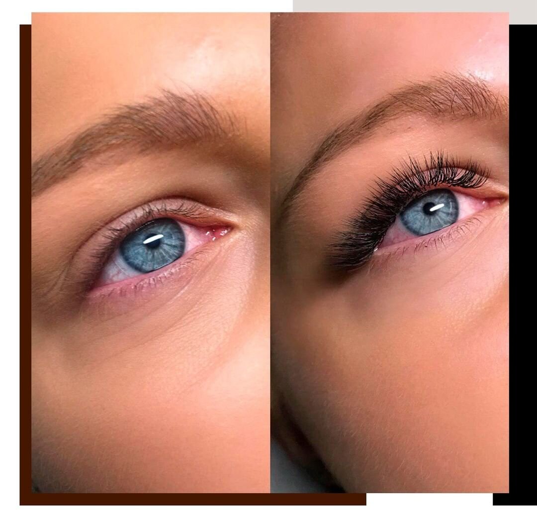 Расширенные зрачки причины. Расширенные зрачки от наркотиков. Разновидности форм глаз. Как понять что человек врет. Как зрачок реагирует на свет.