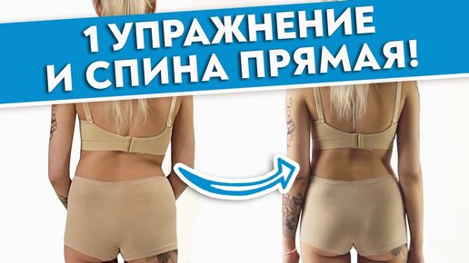 Как выпрямить спину за 40 секунд? СКОЛИОЗ: лечение и профилактика.