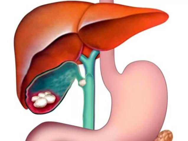 Фотография взята и источника yandex.ru