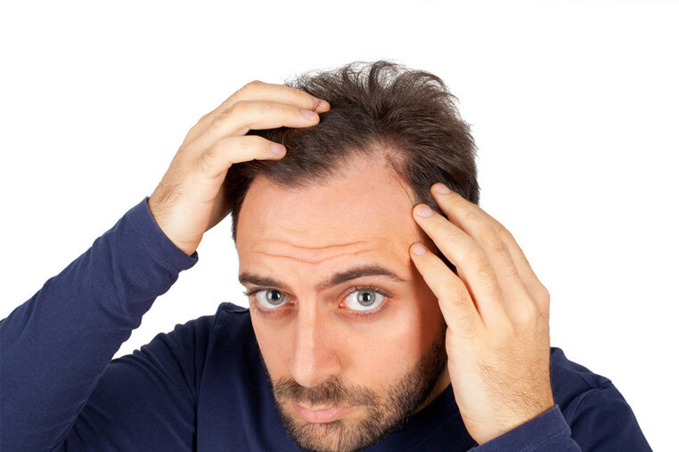 Возникновению прыщей на волосистой части головы больше подвержены мужчины