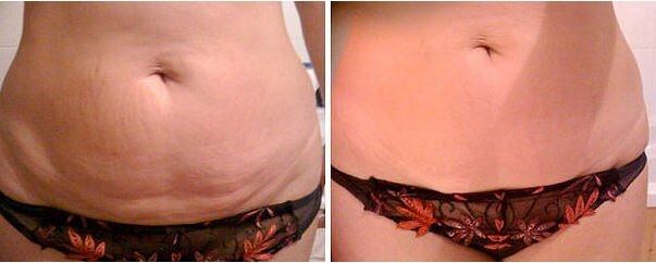 Реальный результат ageLOC® Galvanic Body Trio