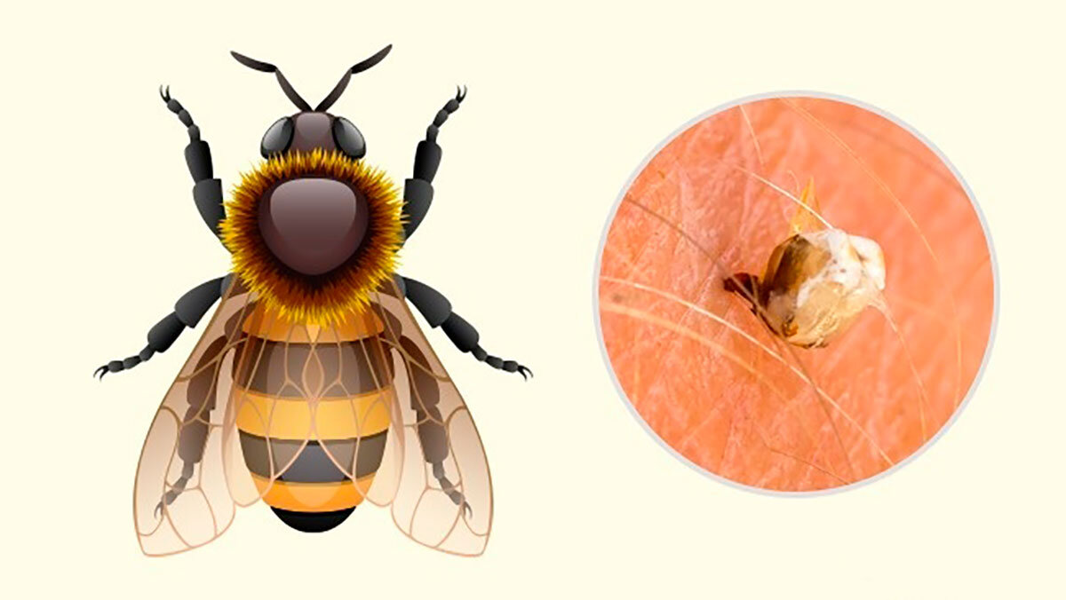 Insect intense. Укусы пчелы вектор. Пчела чей логотип.