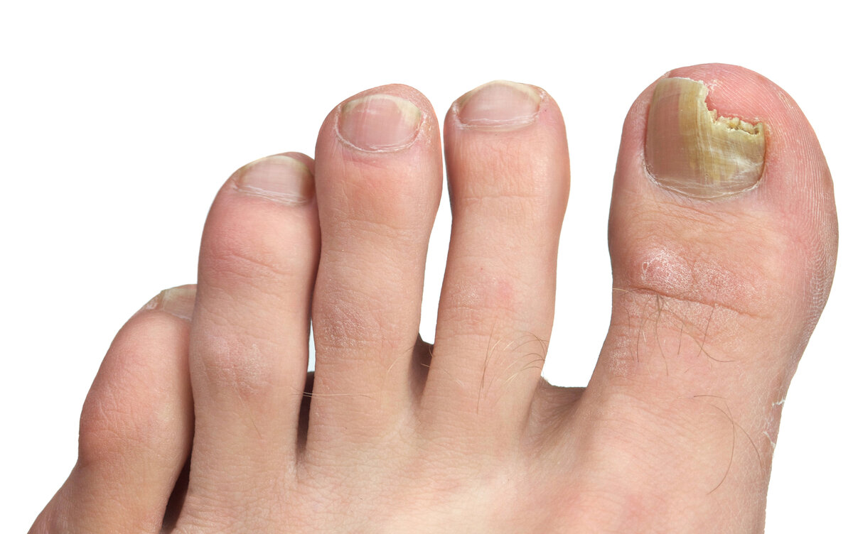 Источник: https://www.footpaindoctor.net