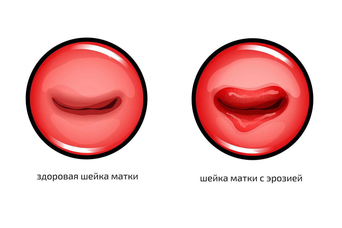 Cтрашные лейкоциты в мазке | Дмитрий Лубнин | Дзен