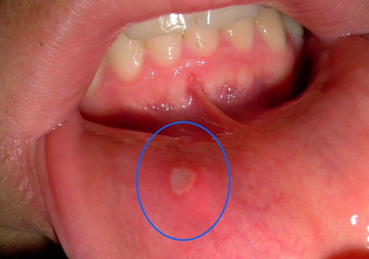 Как таковое поедание козявок безвредно, но в процессе можно занести в ротовую полость много всякой дряни