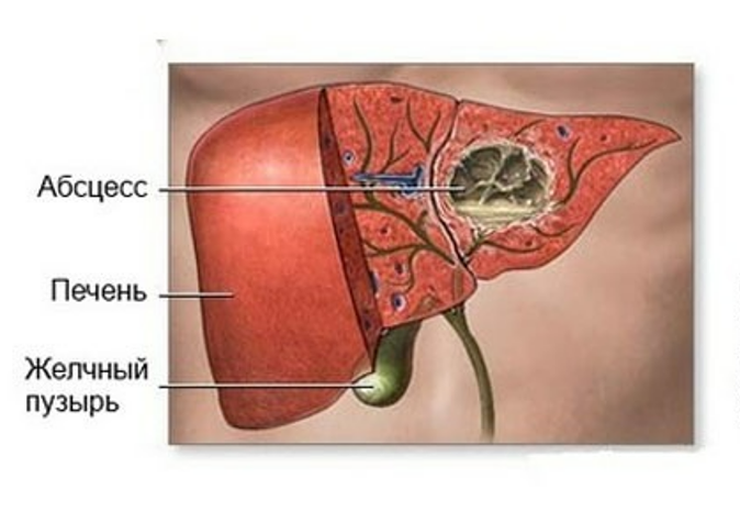 Фотография взята из источника vsepropechen.ru