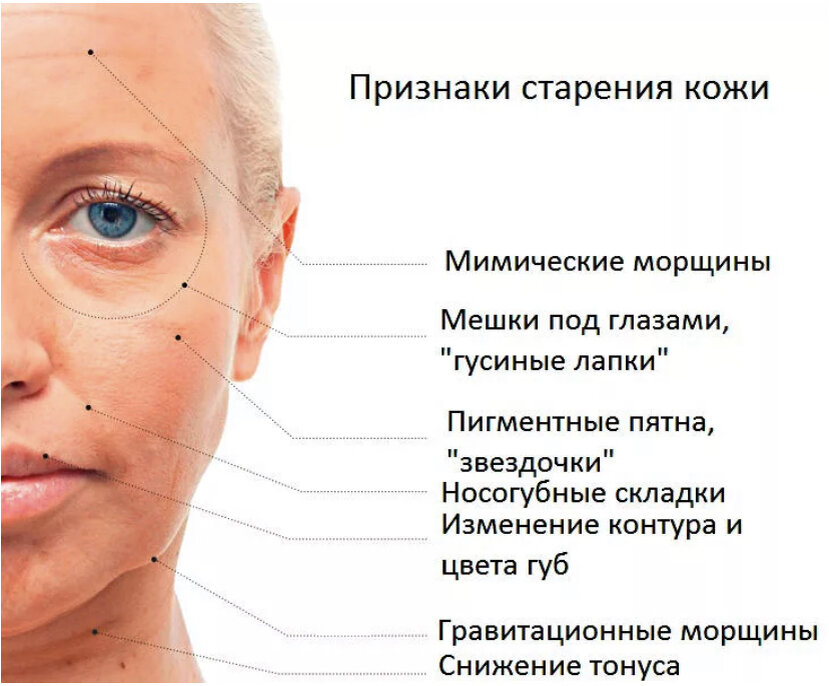 Начиная с 20-25 лет, на коже появляются признаки старения. С возрастом процессы в коже замедляются, структурных белков, которые делают кожу упругой и гладкой, становится меньше.-2