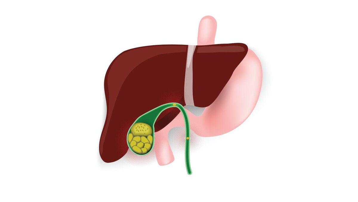 Заброс желчи в желудок или пищевод. Норма это или патология ...
