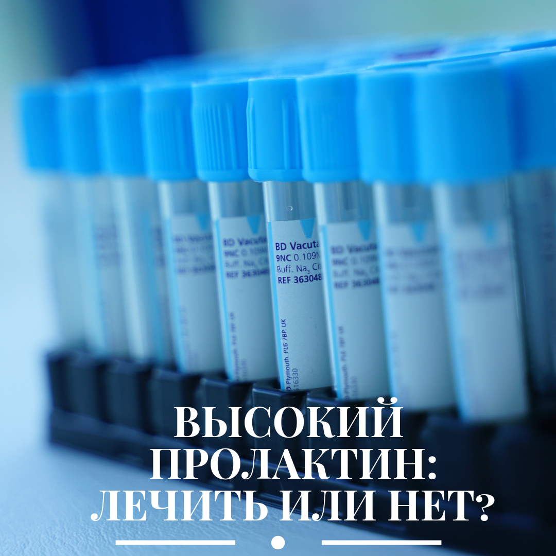 Аденома гипофиза головного мозга - что это такое