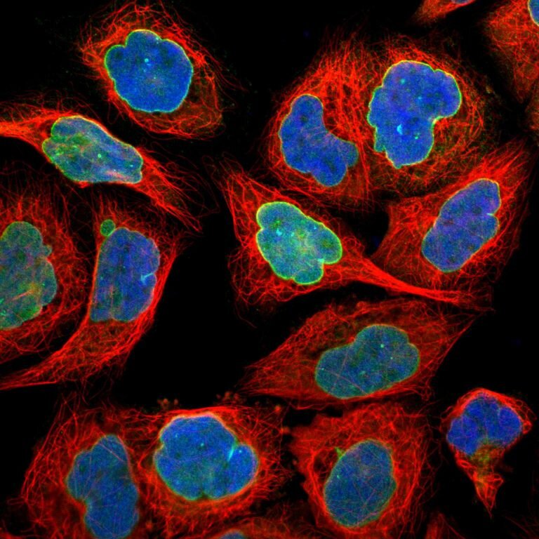 Белок UNC84B в оболочке клеточного ядра. Изображение из базы Cell Atlas.