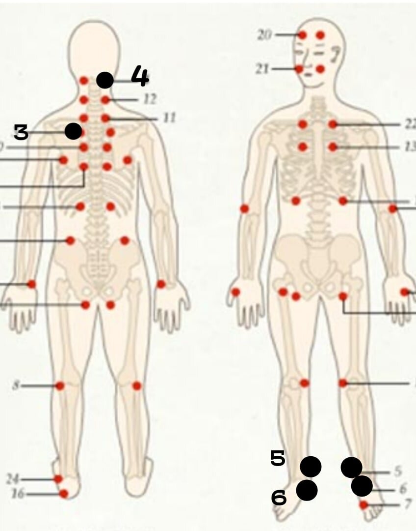 Меридиан перикарда в китайской медицине точки. Меридиан перикарда на теле. Болевые человека болевые точки на теле. Как выглядит 3 точка. Точки акупунктуры на теле человека.