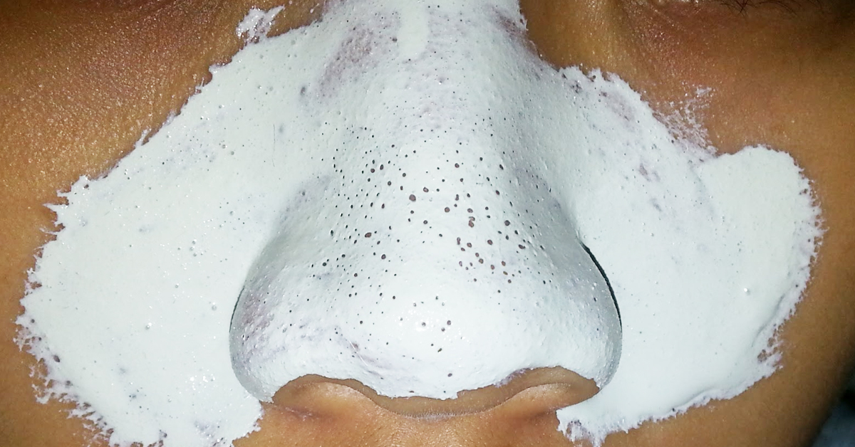 Фотография взята из источника  psoriazweb.ru