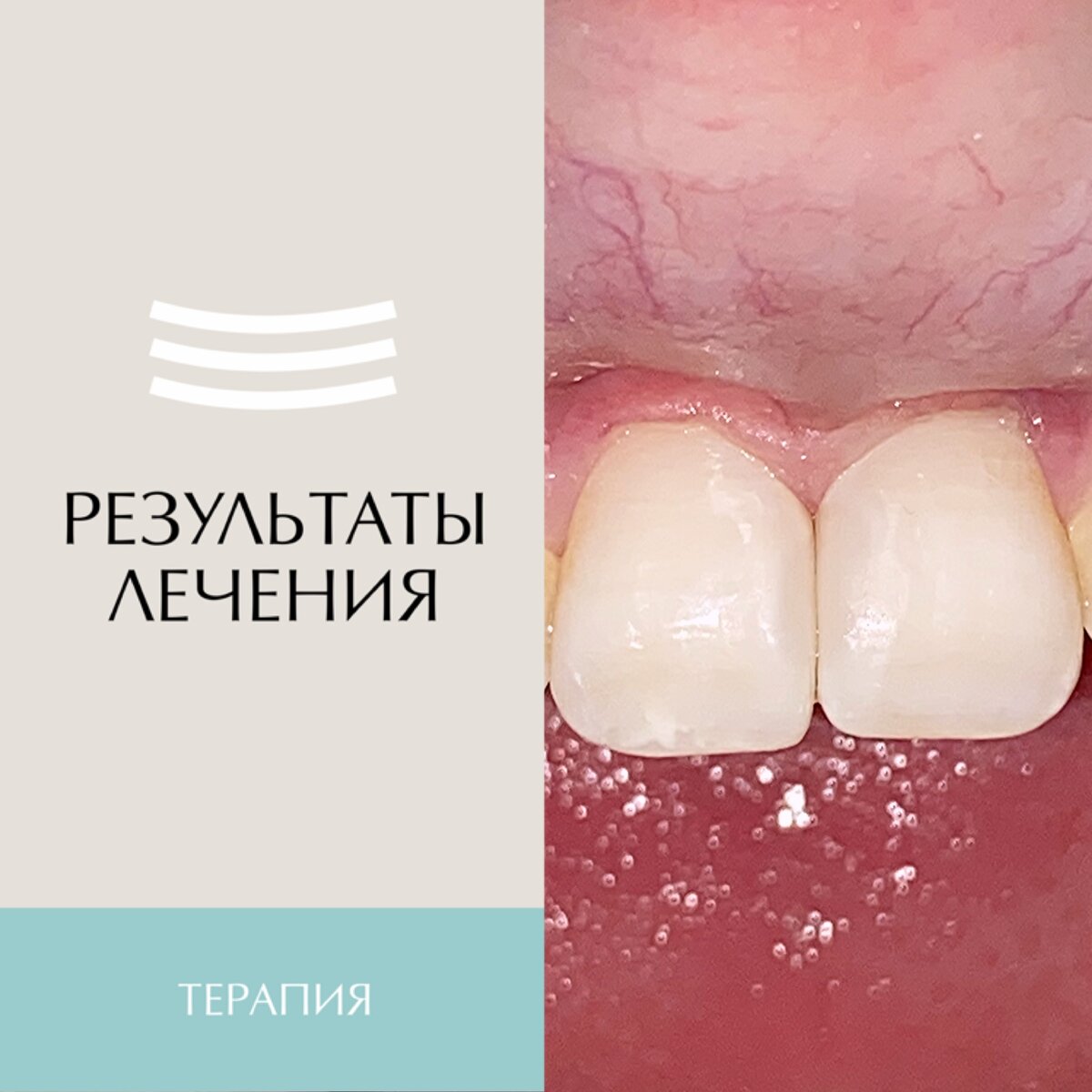 Наш пациент сегодня - мальчик 9-ти лет. 