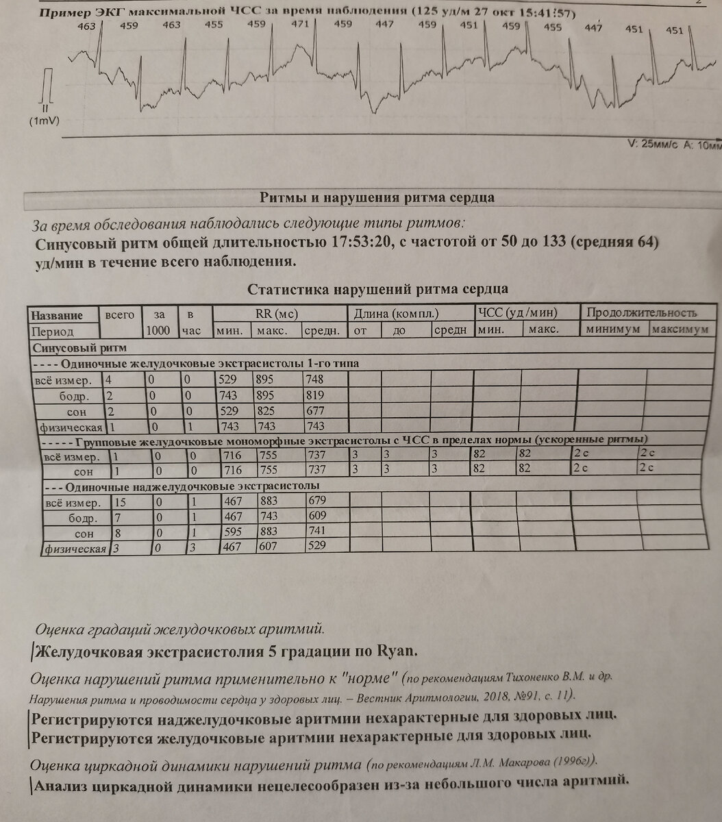 Вот один из моих холтеров