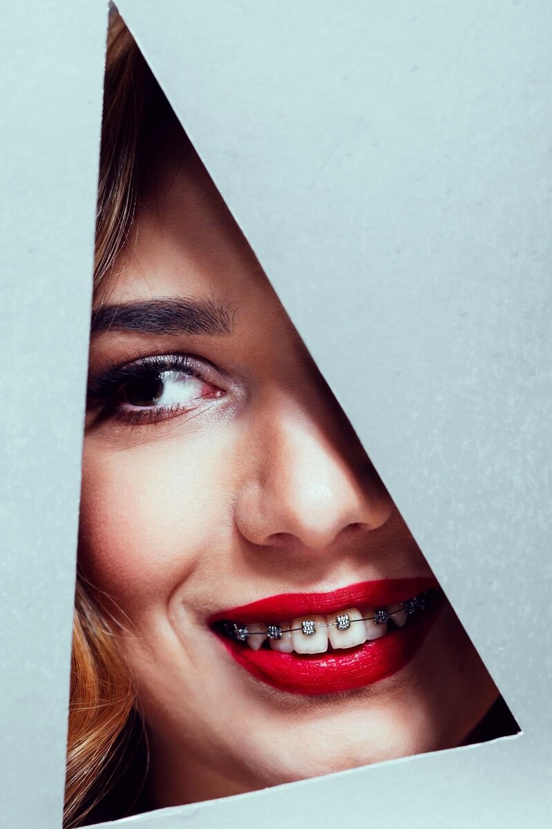 3 причины установить брекеты во взрослом возрасте | Андрей Жук эксперт ...