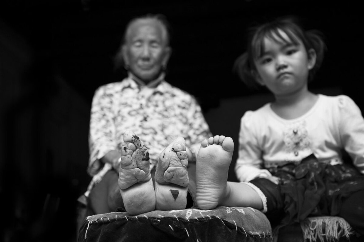 бинтование ног в древнем китае золотой лотос