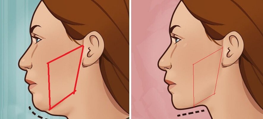 Жевательная мышца: о её влиянии на ваше лицо и деформации | Healthy | Дзен