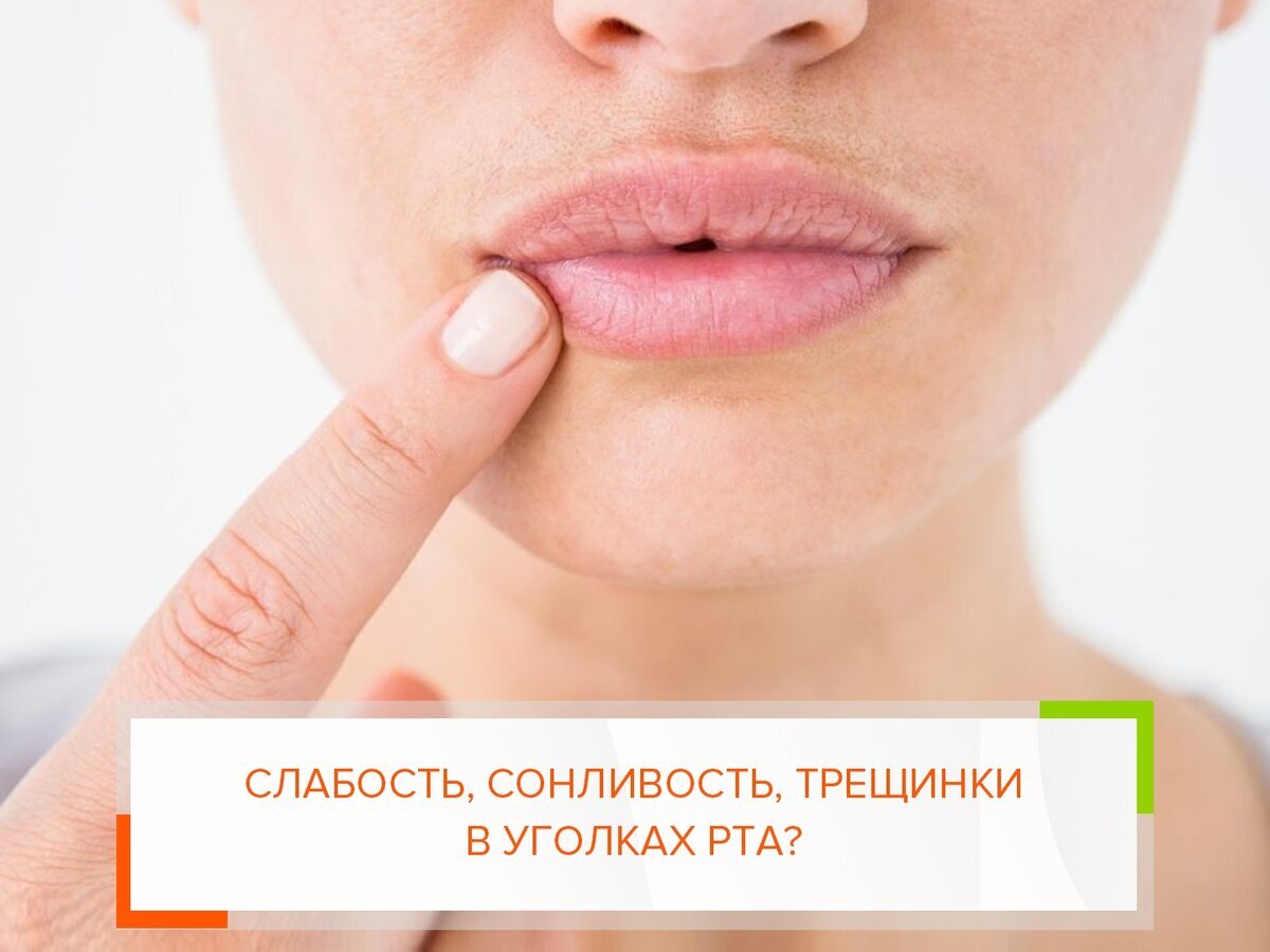 сухая кожа в углах рта. гиповитамизной хейлит. покраснение в уголках рта. эксфолиативный и гландулярный хейлит. экзематозный хейлит губ.