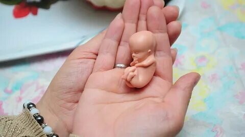 «Не хочу, чтобы из ребенка сделали пособие»: судьба абортивных отходов