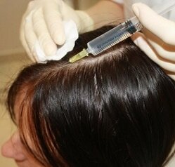 Мезотерапия – процедура, в ходе которой в волосистую часть головы вводятся специальные лечебные препараты. В состав данных «коктейлей» включаются микроэлементы, аминокислоты и витамины, которые положительно сказываются на росте волос и их состоянии.