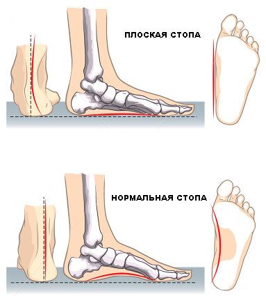 Перед применением проконсультируйтесь с врачом