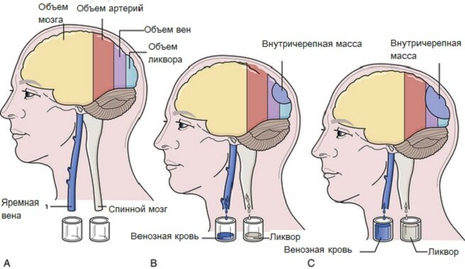 3. Нарушение ауторегуляции кровотока